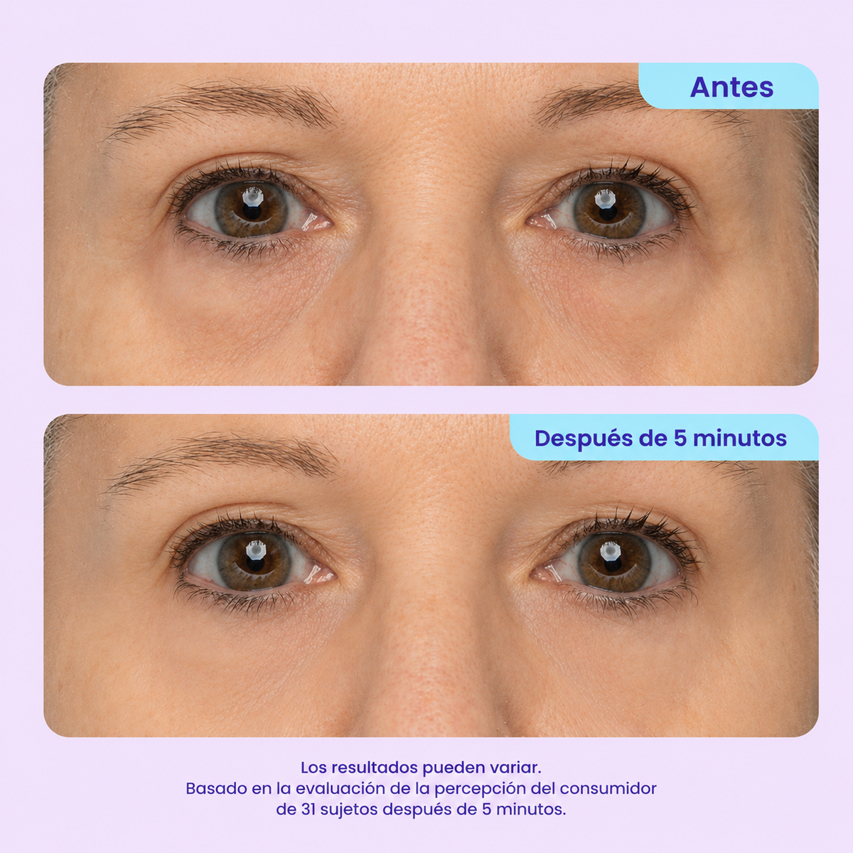 Gel de Ojos con Efecto Rejuvenecedor Instantáneo - #1 más viral en TikTok